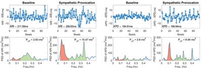 Mechanisms Underlying Interactions Between Low-Frequency Oscillations and Beat-to-Beat Variability of Celullar Ventricular Repolarization in Response to Sympathetic Stimulation: Implications for Arrhythmogenesis